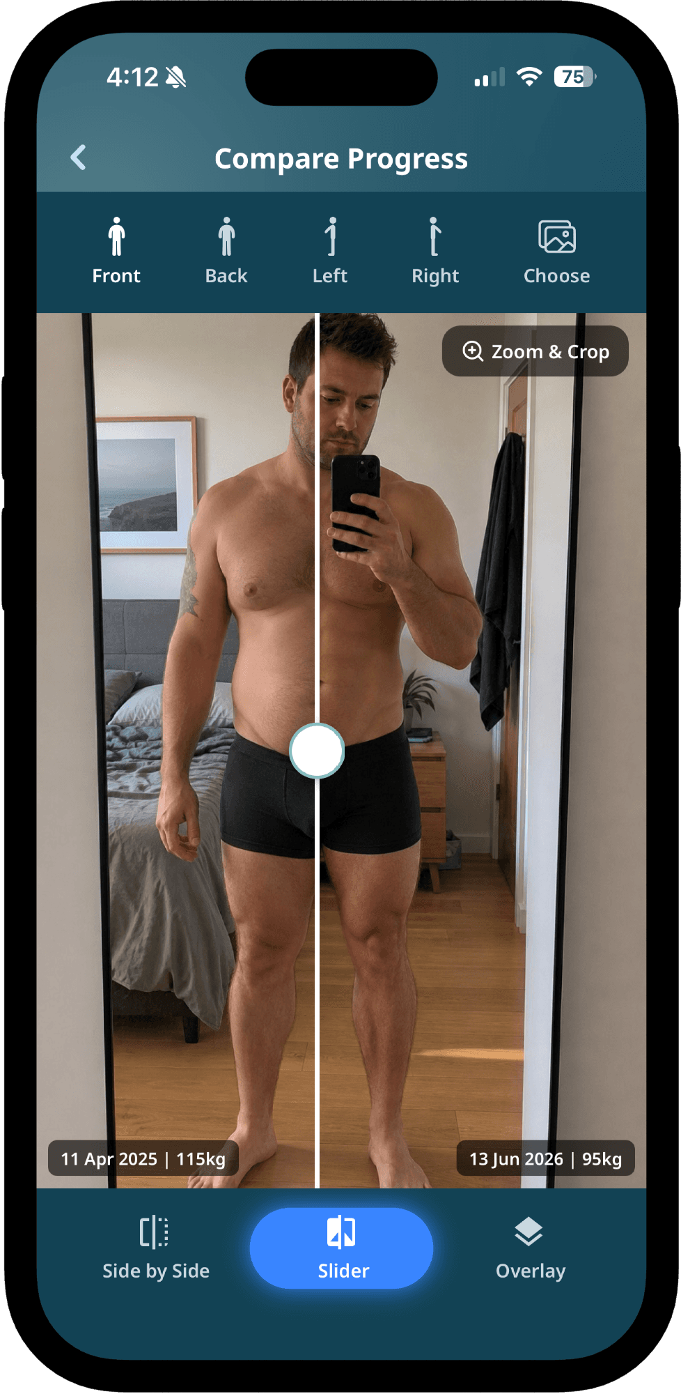 Slider reveal comparison view in Progress Pics - Body Tracker